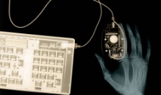 鼠标键盘和手的X光透视图片